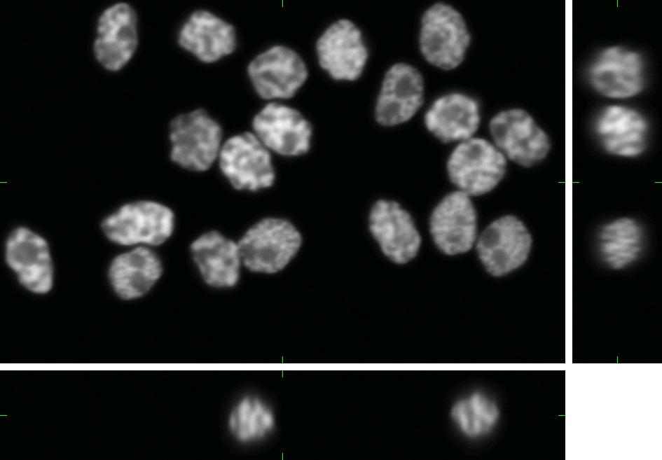 Microscopic grayscale image showing multiple cell nuclei with varied shapes and detailed internal structures on a black background.