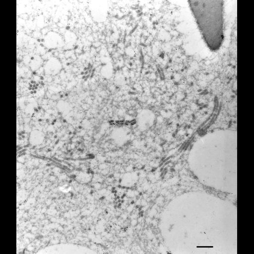 High-resolution grayscale electron microscope image showing a dense network of cellular structures including vesicles, microtubules, and other organelles within a cell.