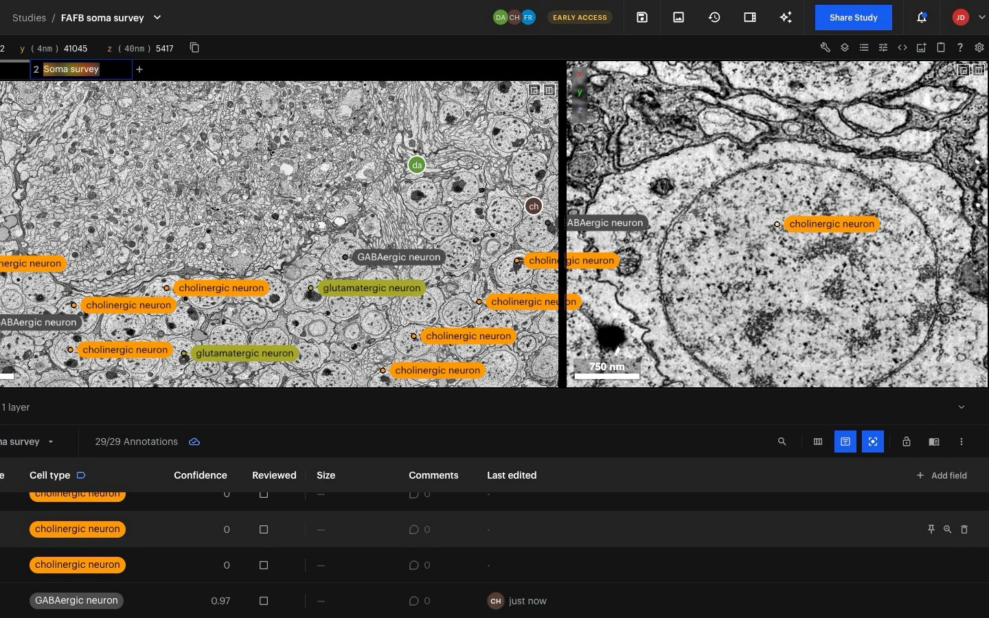 Focus View: a close-up of one annotated cell beside the overview, the annotation table below.