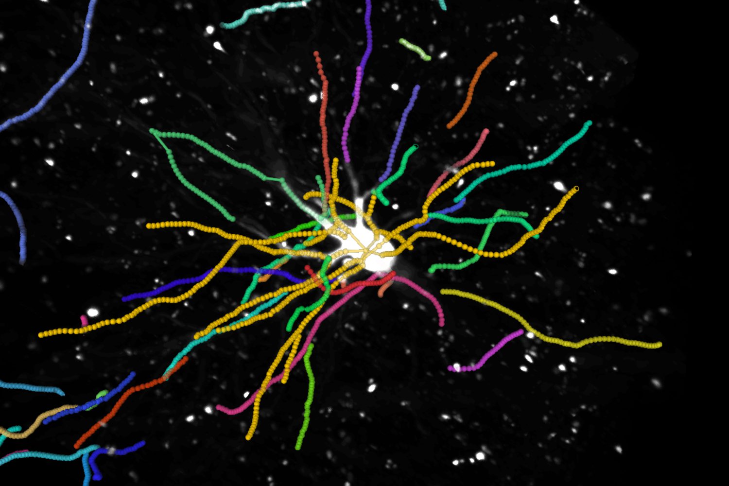 A traced neuron in yellow among software-made fragments in a light-sheet volume.