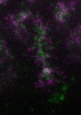 Microscopic image showing green and purple molecular structures on a dark background.
