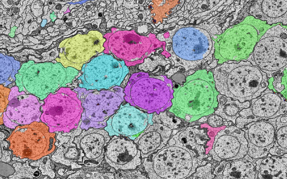 Segmented cells over an electron-microscopy section.